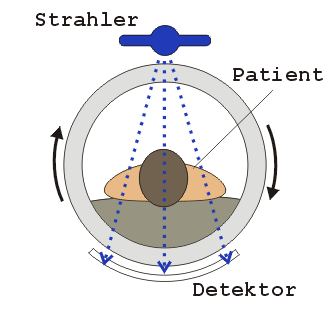 Illustration von CT Untersuchung