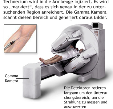 Ein MRT-Gerät mit Erklärungen