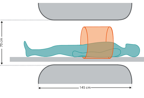 Illustration von offener MRT Gerät