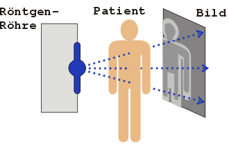 Das Bild zeigt den Ablauf des Röntgen